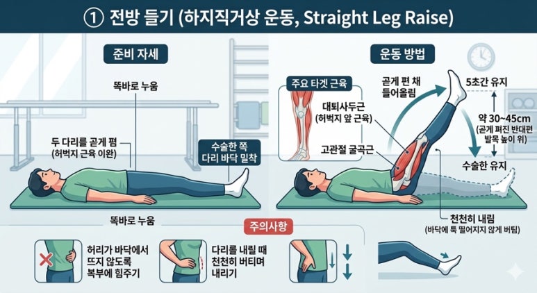 무릎 수술 환자를 위한 4방향 고관절 운동 교육 지침 썸네일