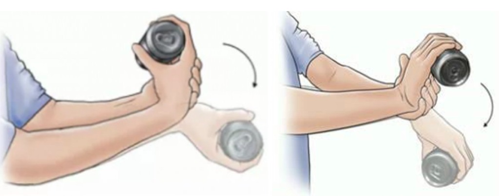 팔꿈치(테니스 엘보, 골퍼스 엘보) 신장성 수축