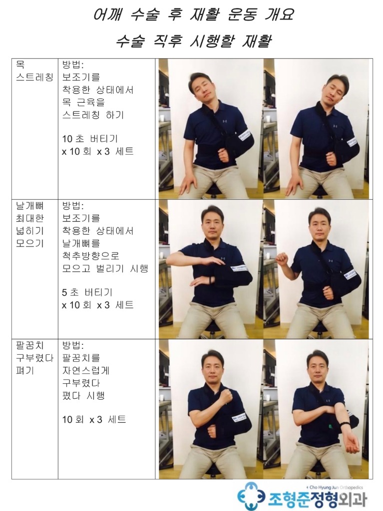 어깨 수술 후 재활 운동 개요 1